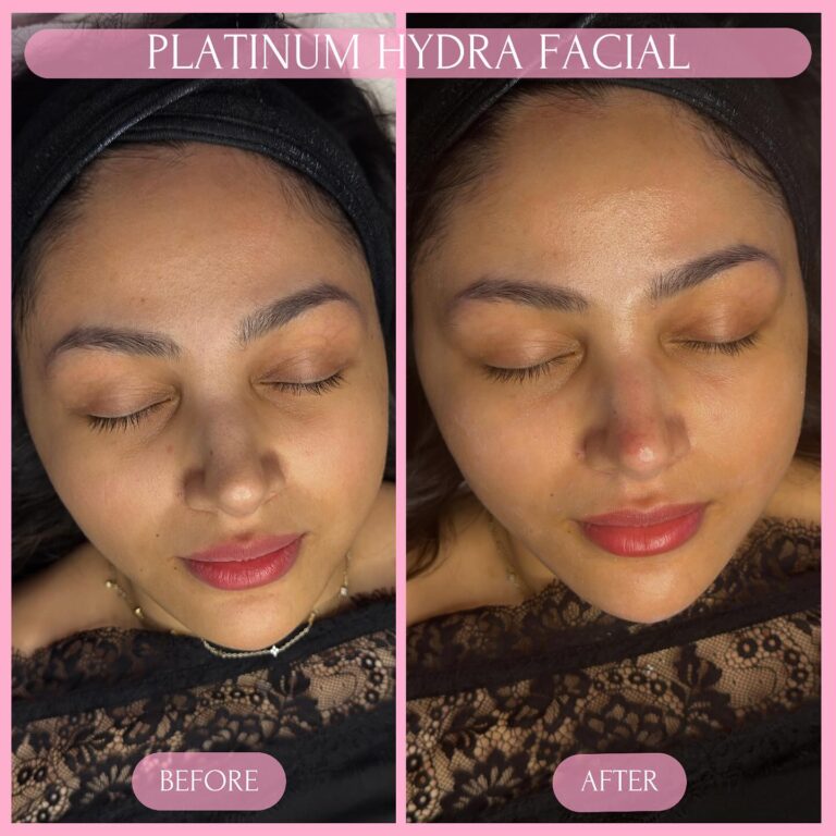 503612878_18092698240616528_5372851621667999007_n